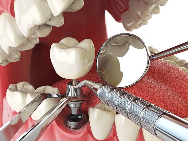Best Emergency Treatment for Jaw Pain or Injury in Lock Haven, PA